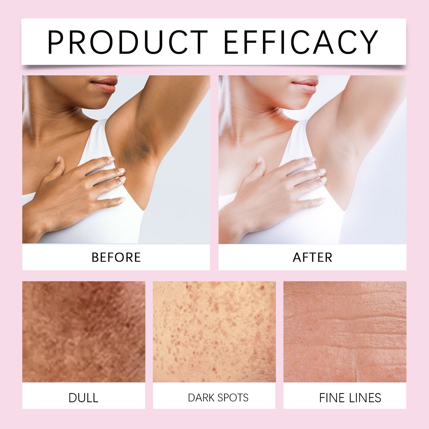 Reviorepeau Dark Spot Corrector Cream — Fade Scars, Reveal Your Glow